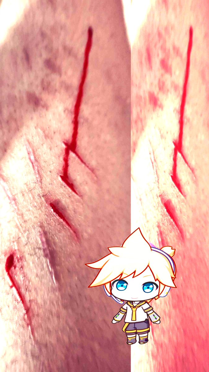 ᪖ ྀི Sora◞ཀ ᴸᵉⁿ ᵒᶠ ˢʰᵉᵈᵗʷᵗ ᵎᵎ tweet media