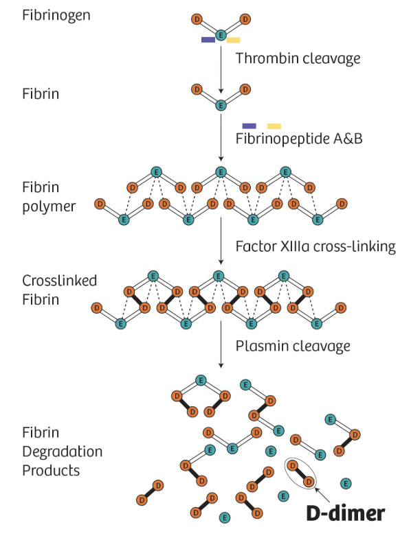 Papa_Heme's tweet photo. What's a D-dimer?

Fibrinogen = 3 domains = central E + 2 D

Thrombin cleaves fibrino-peptides (A,B) in E 
= Fibrin monomers

With fibrin-peptides A + B gone monomers can polymerize

Fibrin monomers polymerize = Fibrin polymers

FXIIIa crosslinks D in polymers = (D-D)E-(DD)E... = cross linked fibrin->clot stabilized and leaves behind some (d-D) = D-dimer!