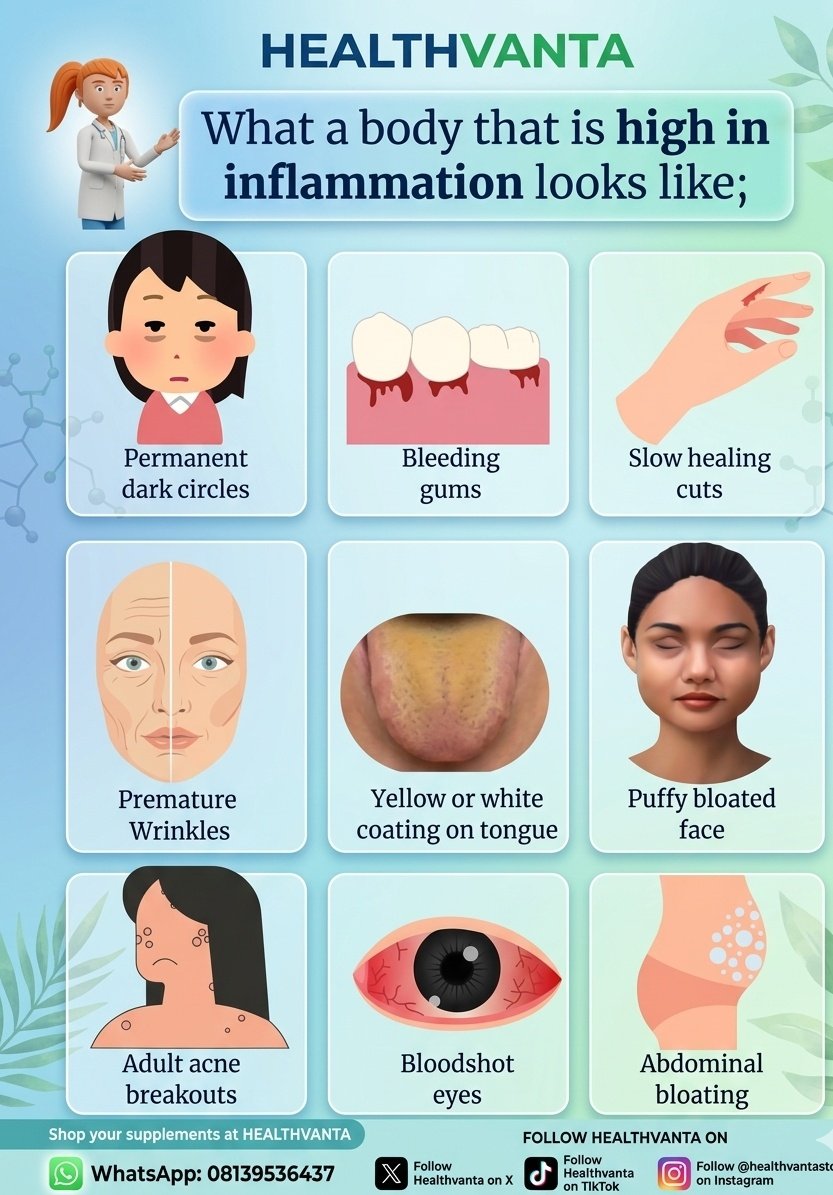 healthvanta's tweet photo. Is your body sounding the alarm? 
Chronic inflammation often shows up through subtle signs like persistent dark circles, bloating, or skin breakouts. Don't ignore these signals, support your health with premium wellness solutions. https://t.co/f2idAiwKG8
