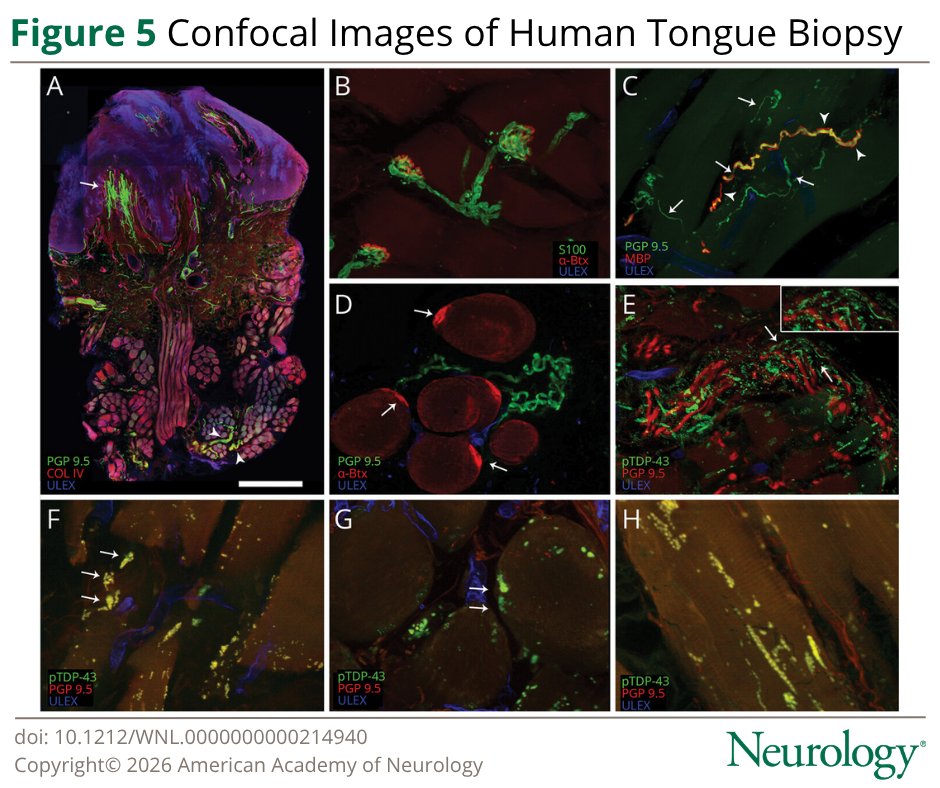 Neurology Journal tweet media