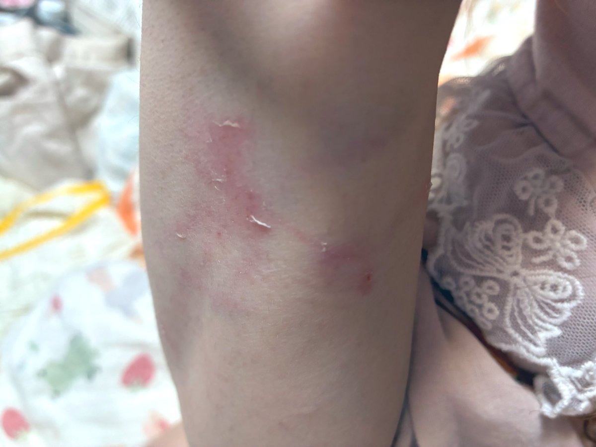 条子跑我家里帮我割手的意思