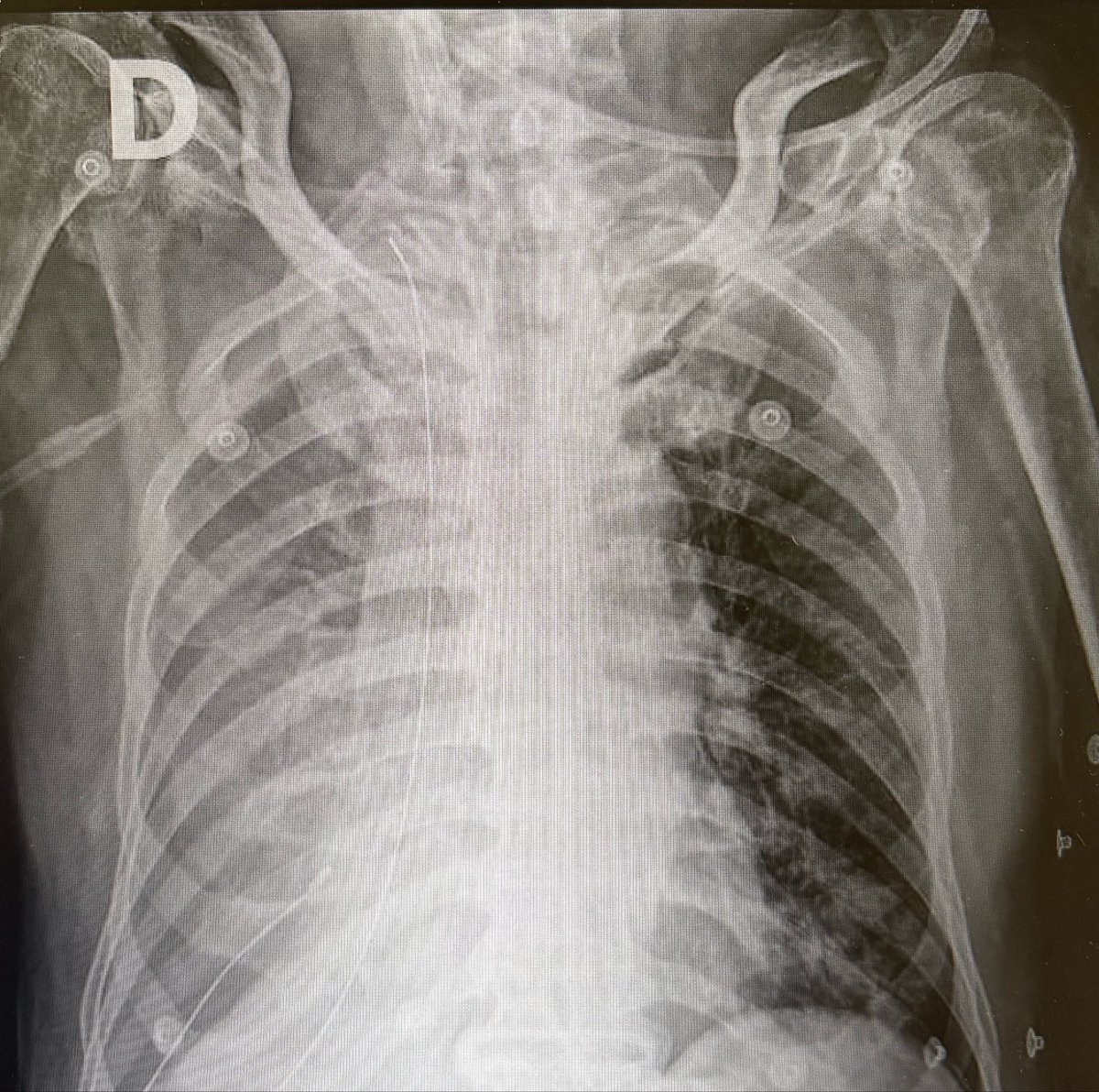 torniquetecervical tweet media