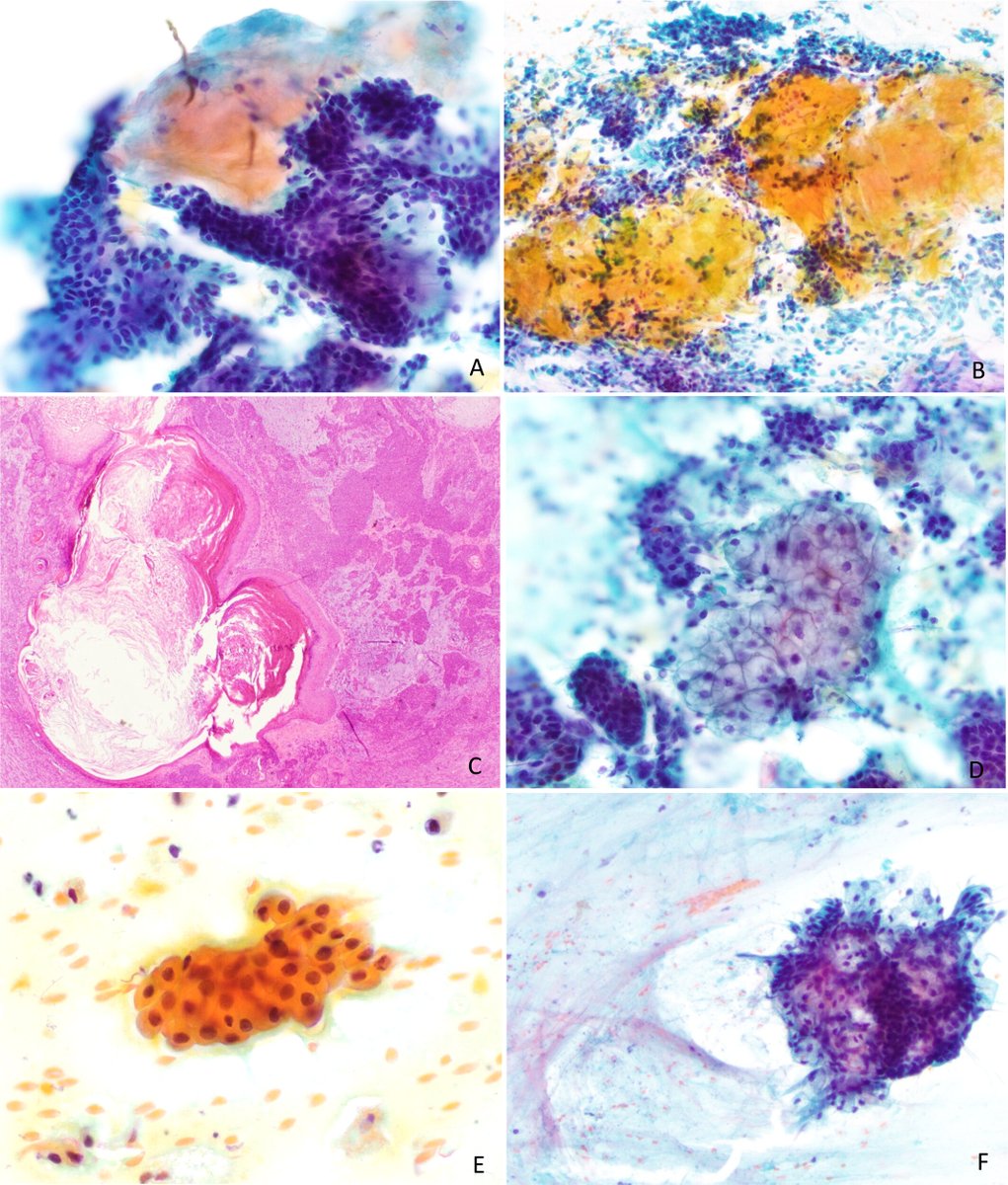 Cancer Cytopathology tweet media