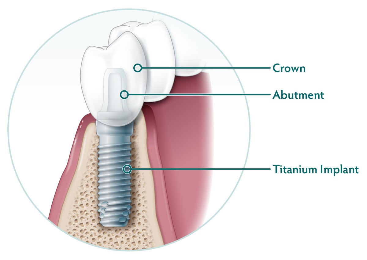 AAOMS - Oral and Maxillofacial Surgeons tweet media