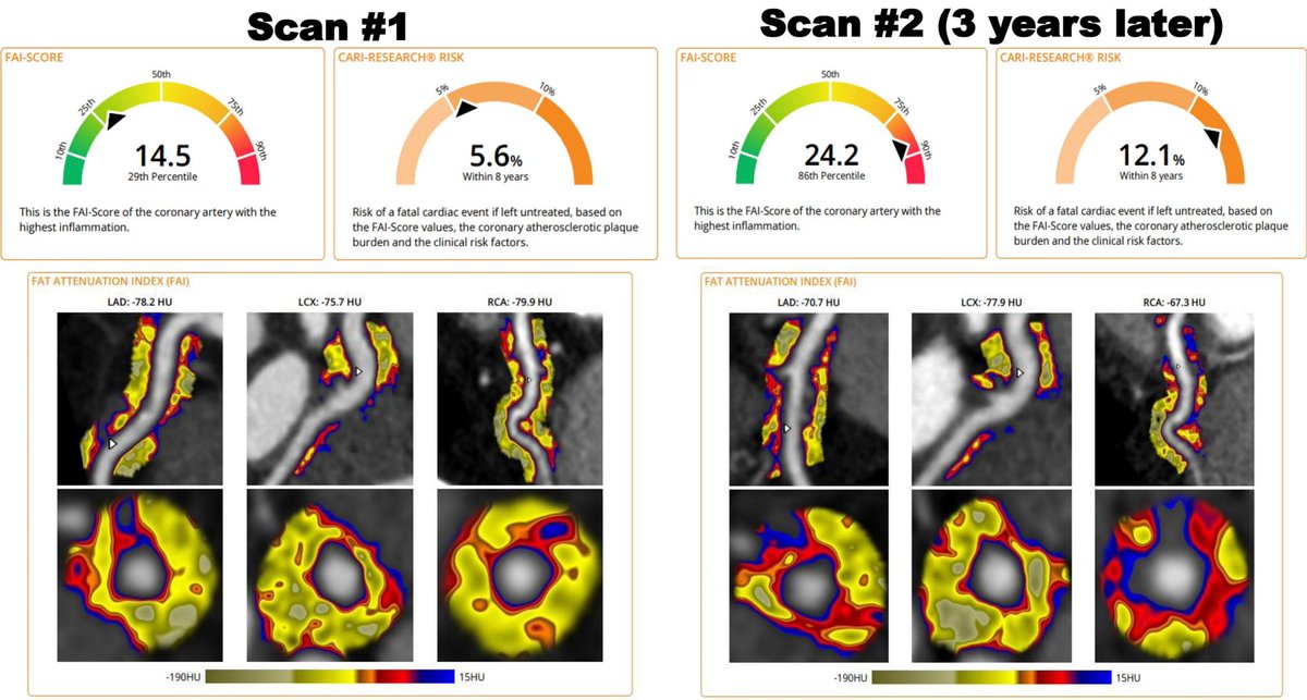 Progress in Cardiovascular Diseases tweet media