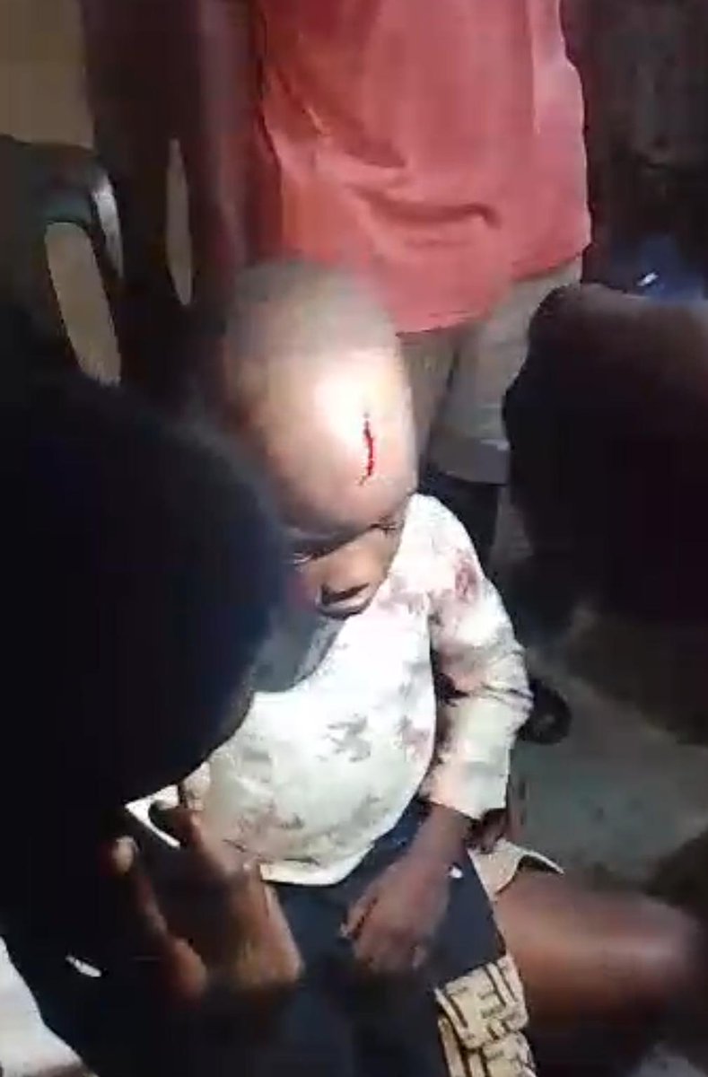 StephenUba8's tweet photo. Alexander stup
A 3-year-old boy in Imo State 🇳🇬
Attacked by Fulani jihadists.
This is why Simon defended Biafra land & Christians.
But YOU took him away.
Tell us — how do we defend ourselves now?
#FreeSimon Ekpa #Biafra https://t.co/KBHPxsq5bs