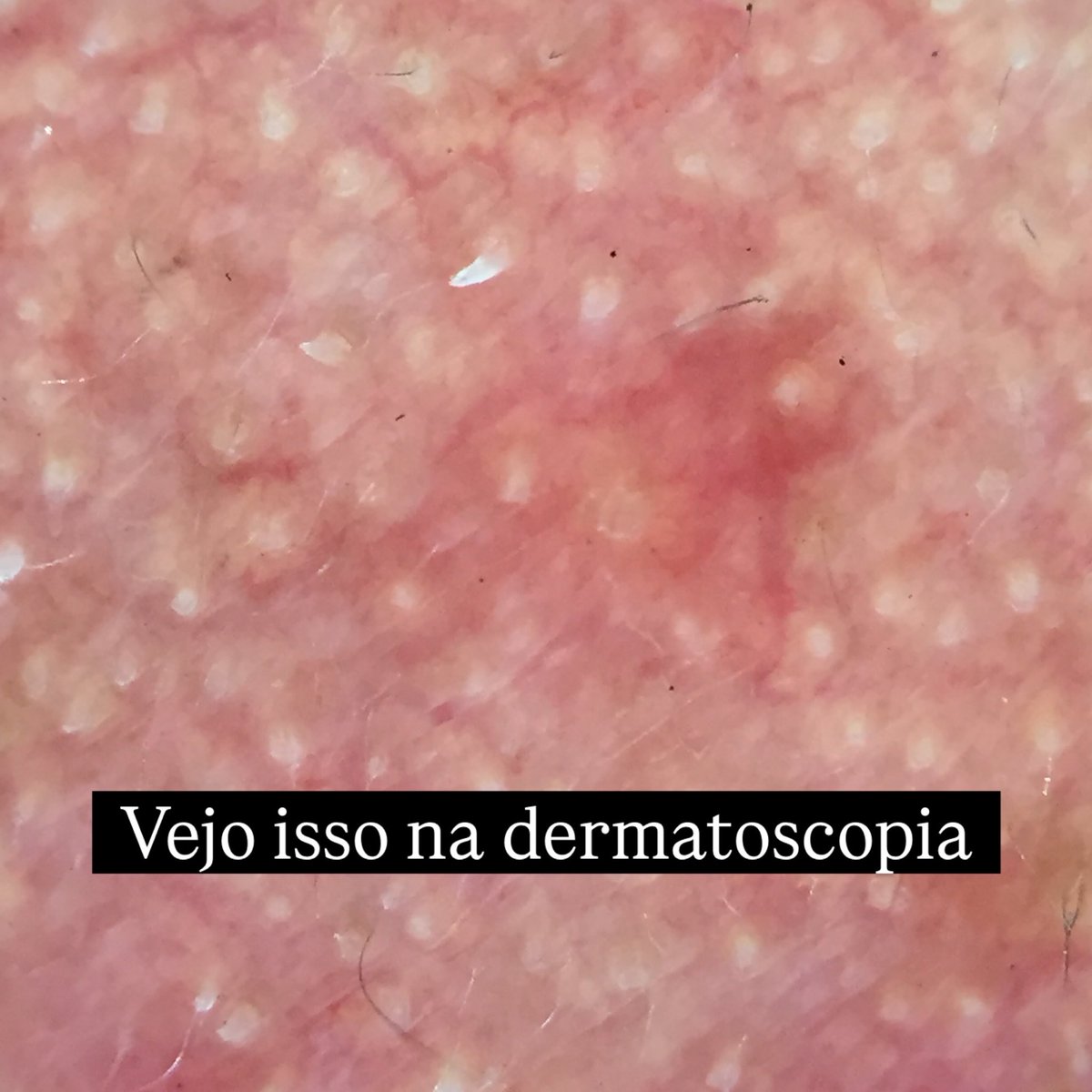 Dermatologia's tweet photo. https://t.co/2uUvxSBN1m
