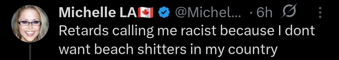 🕳ZombieShooz🕳 tweet media