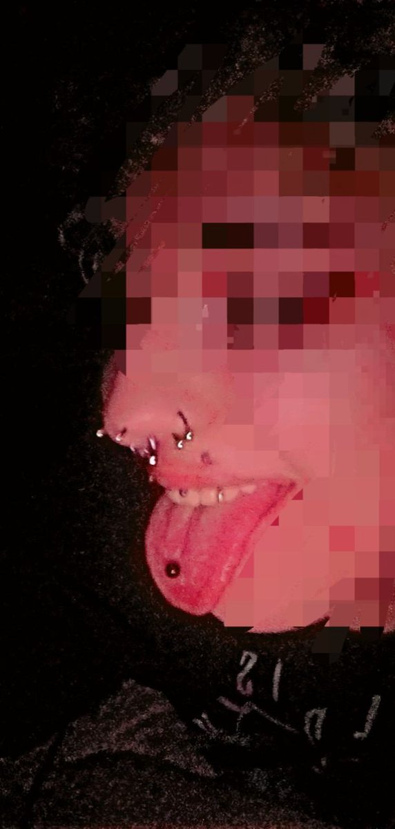 Mongrel🔞 tweet media