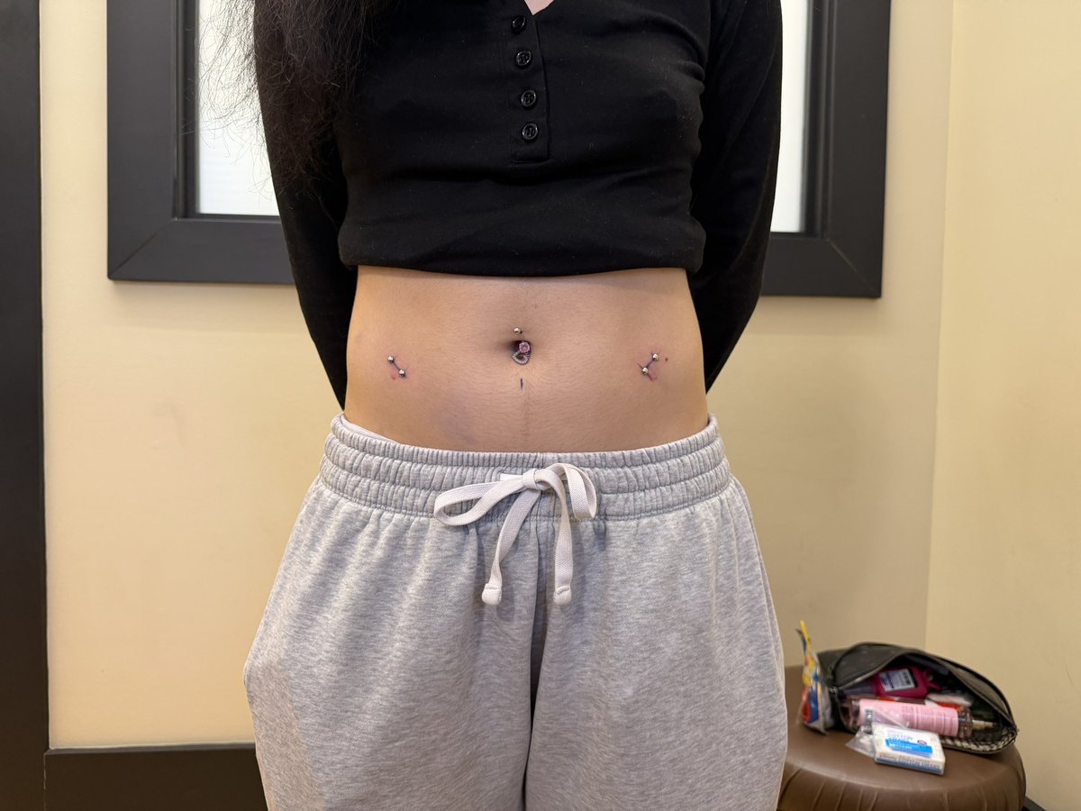 stabzaddy's tweet photo. Fresh surface bars on the hips. https://t.co/MZYVJhaTLE