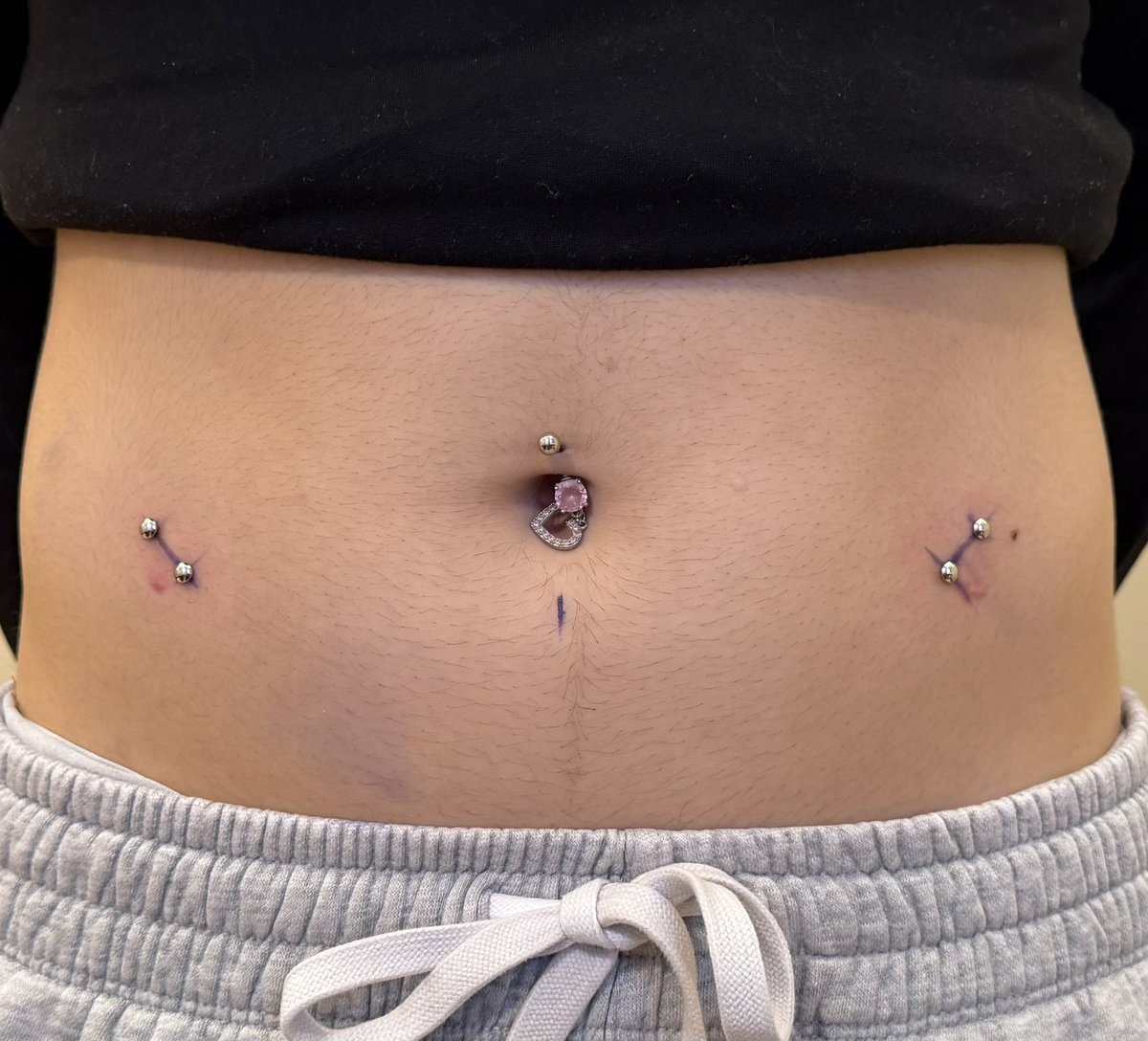 stabzaddy's tweet photo. Fresh surface bars on the hips. https://t.co/MZYVJhaTLE