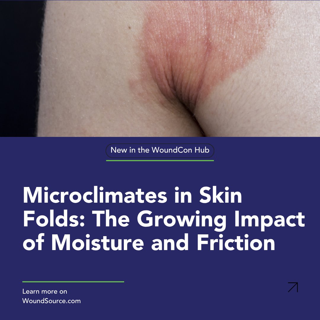 WoundSource's tweet photo. Skin folds create their own “microclimates” and in wound care, those environments can quickly become high-risk zones for MASD. Understanding microclimate management is becoming more important across care settings. Read more here: https://t.co/VRrWCwsJNK
#MASD #WoundSource https://t.co/ZPNG293Pfu