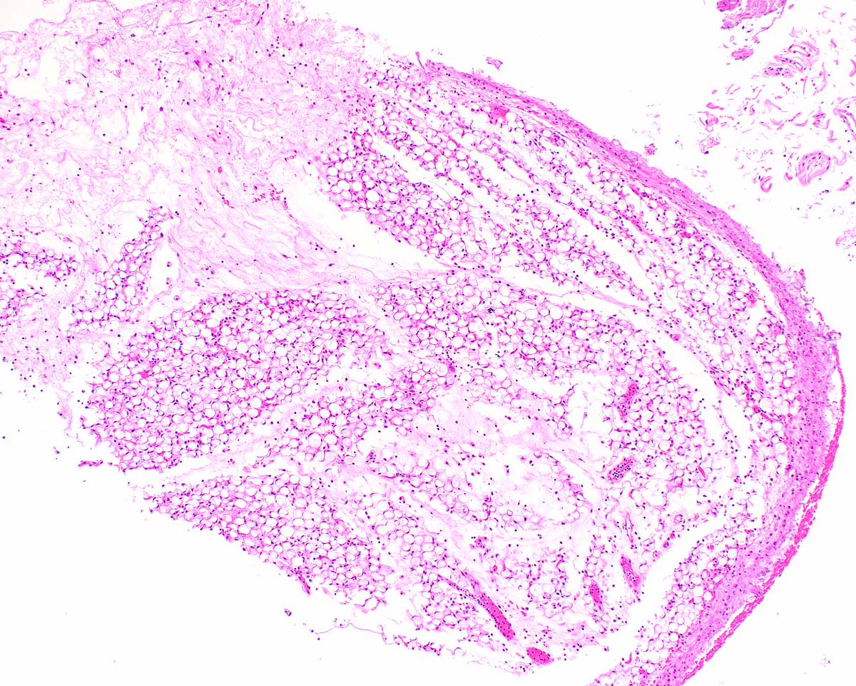 Modern Pathology tweet media