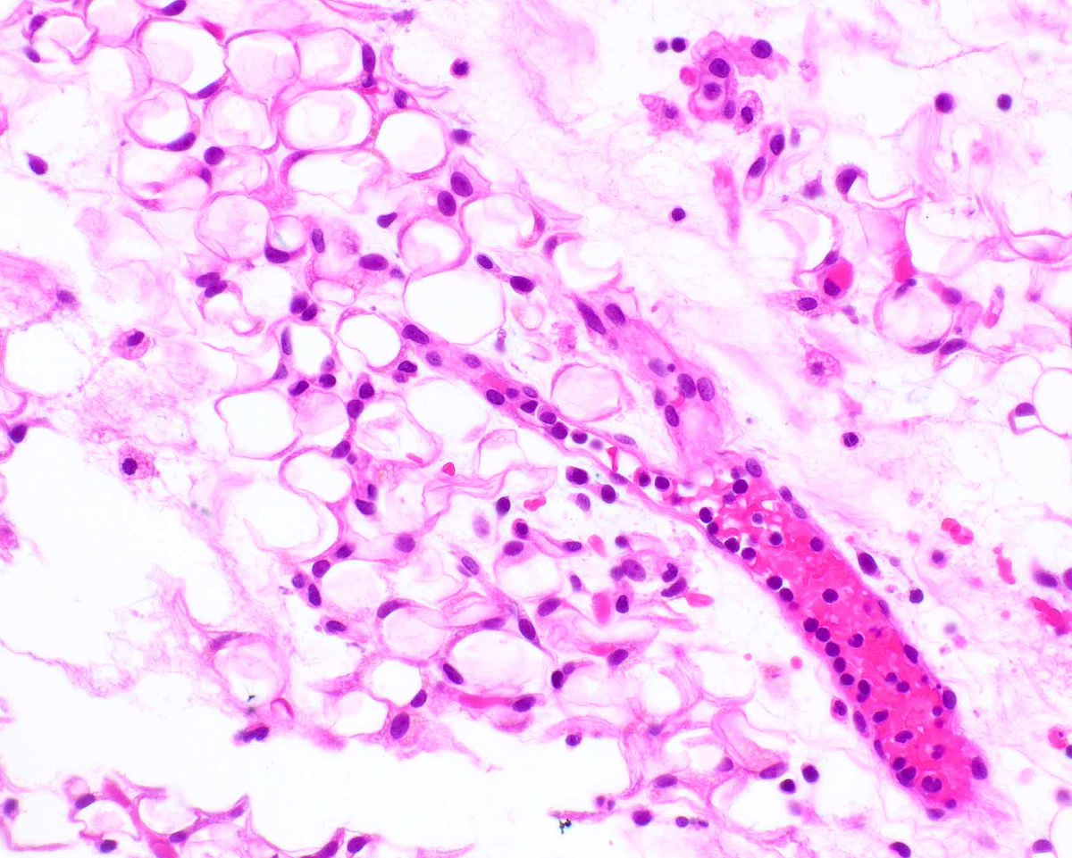 Modern Pathology tweet media