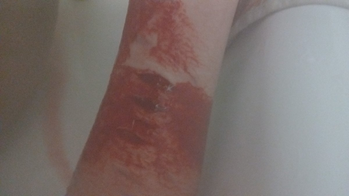 2PPoland's tweet photo. My arms hairy as shit balls bro https://t.co/dtG2H84mAM