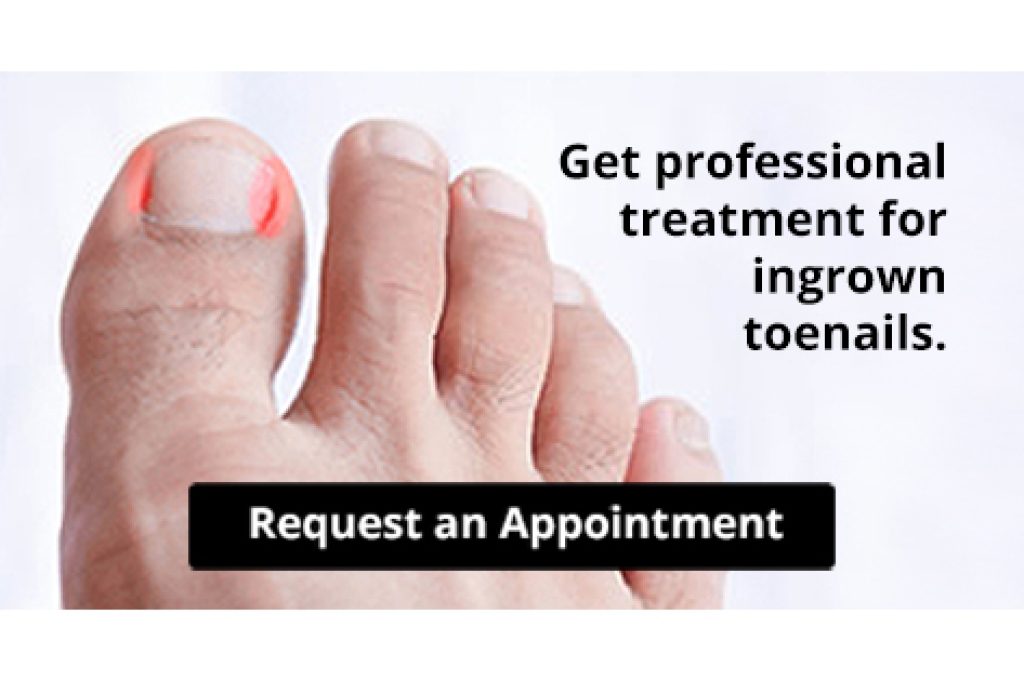 DrAlanSpector's tweet photo. Are You Suffering From Ingrown Toenails? https://t.co/4omwh8i351 https://t.co/ACYi3H8oTj