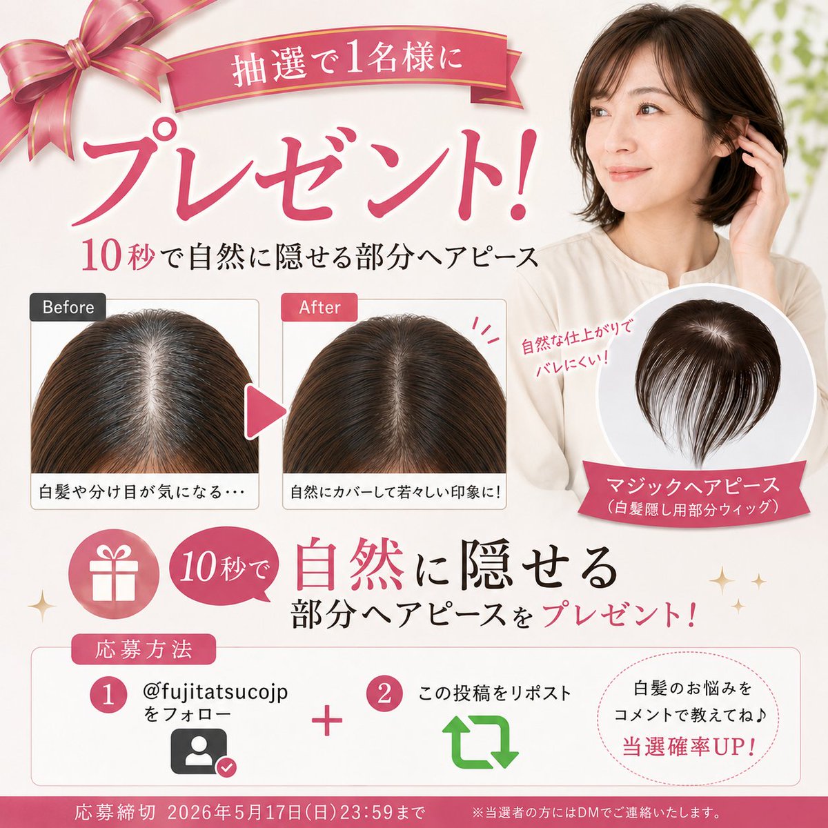 日本ヘアピース研究所｜富士達 tweet media