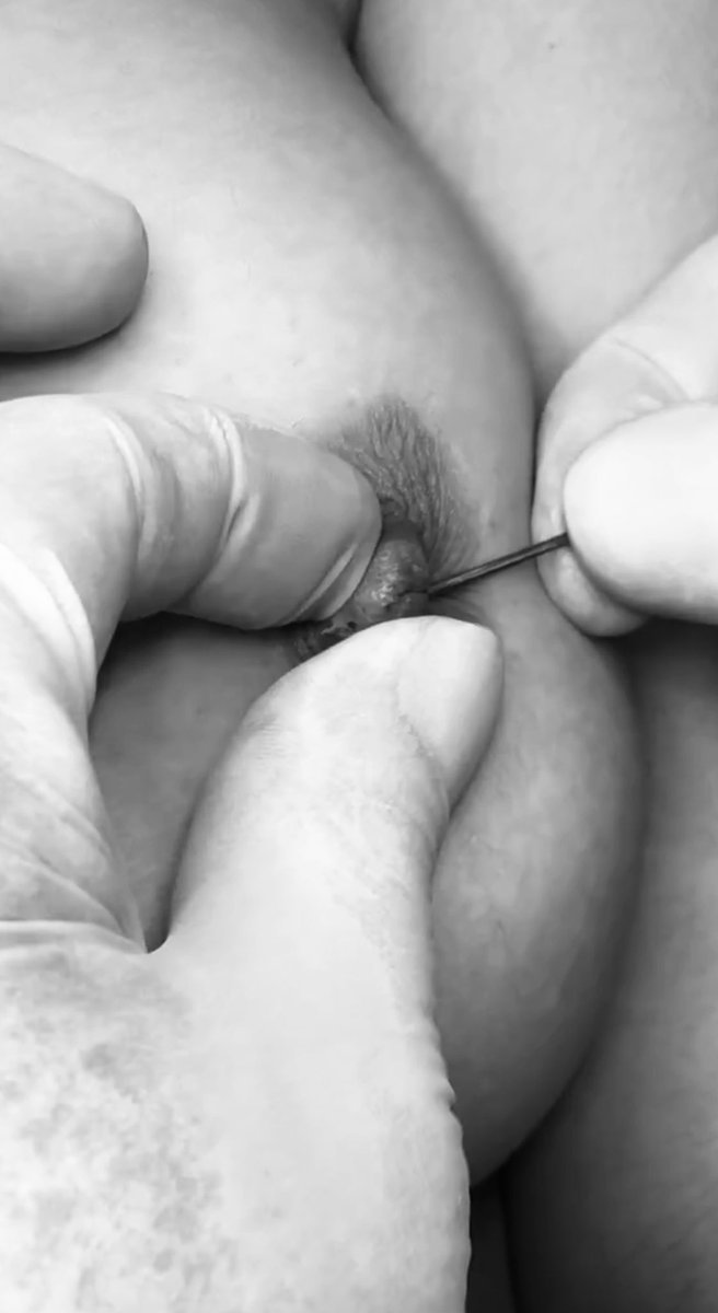 Piercing🔞 tweet media