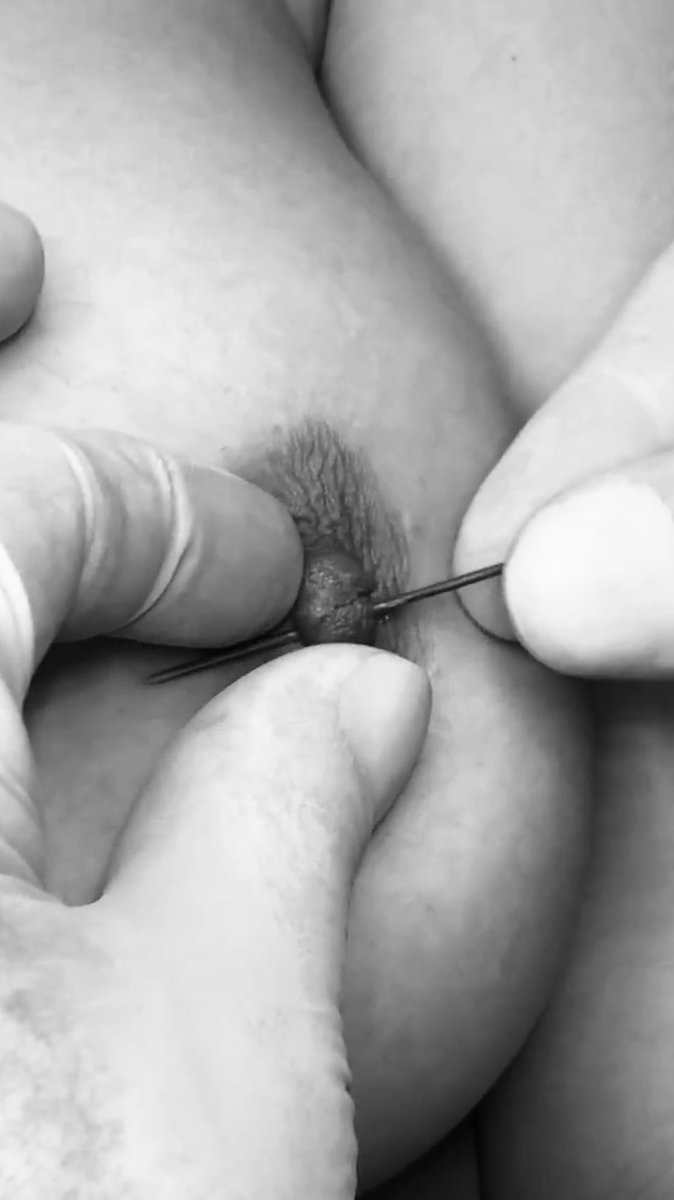 Piercing🔞 tweet media