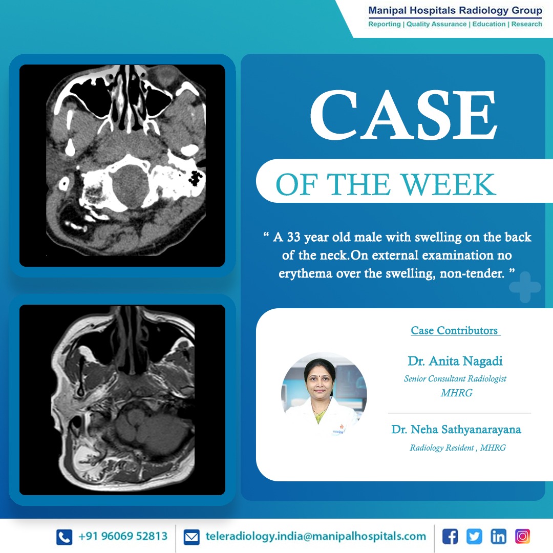 Manipal Hospitals Radiology Group(MHRG) tweet media
