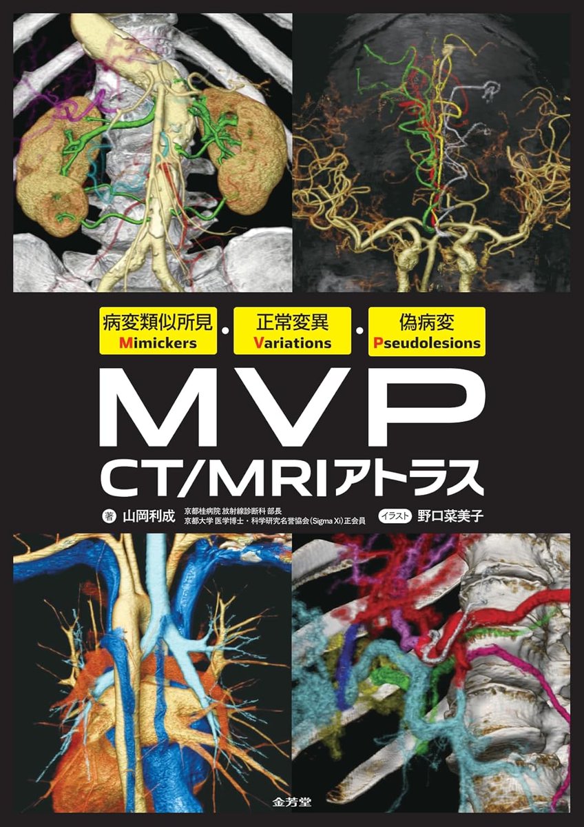 献本御礼】病変類似所見Mimickers・正常変異Variations・偽病変