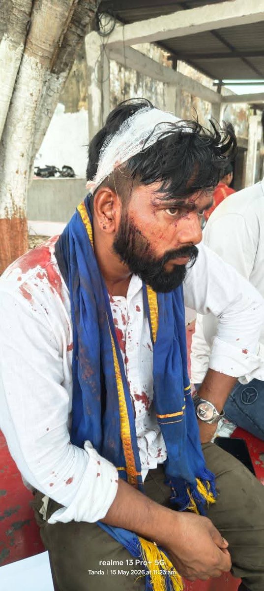 RaviComputerWo1's tweet photo. अंबेडकर नगर के आलापुर विधानसभा के भीम आर्मी विधानसभा अध्यक्ष चंदन आजाद के ऊपर जानलेवा हमला टांडा थाना अंतर्गत हुआ है तत्काल दोषियों को गिरफ्तार किया जाए  भीम आर्मी आन्दोलन के लिए बाध्य है 
@highlight #dmambedkar @ambedkarnagrpol
@Uppolice @dgpup https://t.co/uPSCxscqzM