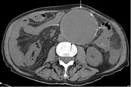 CardiovascularCorner tweet media