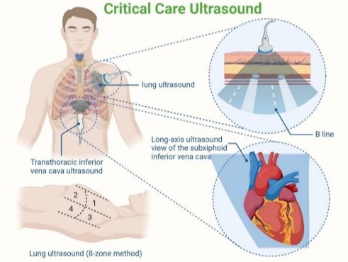 Leo_Santo5's tweet photo. 🔥💧Métodos para Guiar la Reanimación con Líquidos en Pacientes con Quemaduras Graves 

🔰📚Journal of Clinical Monitoring and Computing

https://t.co/pvKAc5N02g

Enlace a Artículo Completo👇🏻🆓✅
https://t.co/xumUMHaxVK https://t.co/JX6ABwNZ1H