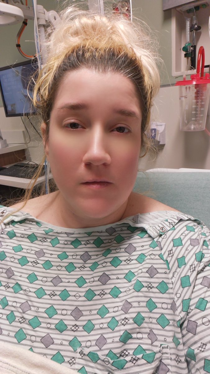 The_Fanily's tweet photo. It's fun going to the ER bc you feel like you're dying, but they won't give you any pain meds for hours bc they want 10 different tests to prove that you're not pregnant, even after you've given 2 reasons that it's impossible for you to be pregnant.  Women don't matter in the US. https://t.co/vIhvELQkng