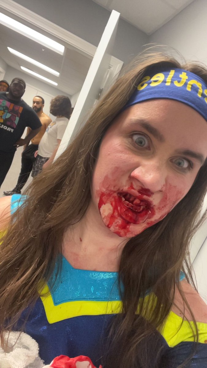 ShannonLevangie's tweet photo. In honor of me having my first matches back in two months this weekend, here are some pictures explaining why I have not in fact been wrestling for two months 😁 https://t.co/dNNH8s3NK3