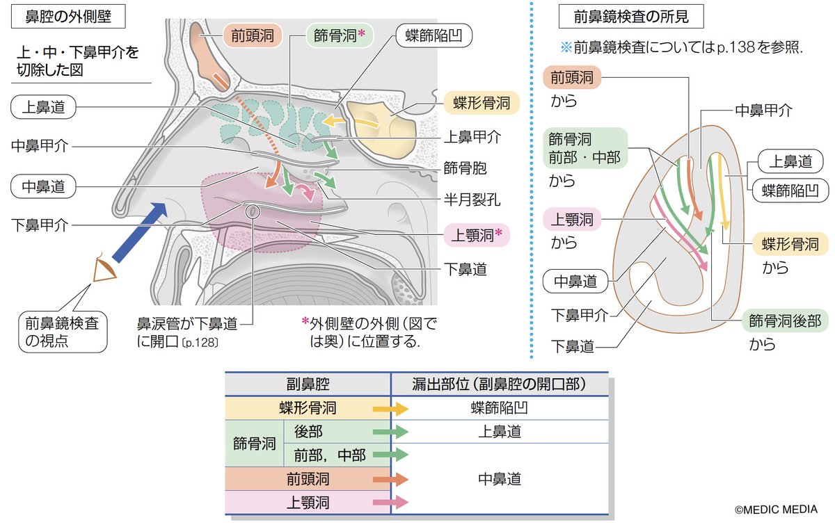 【副鼻腔の開口部】鼻腔を取り囲む頭蓋骨の内部にある空洞を副鼻腔とよび、前頭洞、篩骨洞、蝶形骨洞、上顎洞の4つがある。副鼻腔に貯留した分泌物は副 ...
