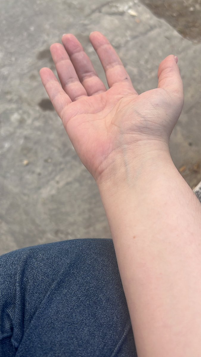 aimilaki_94's tweet photo. @DanixxxinaD @N0VFS @magills_ That’s my skin. https://t.co/DesOUWhLmy