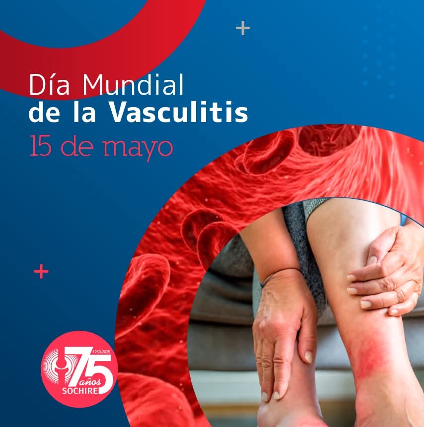 sochire's tweet photo. En el Día Mundial de la Vasculitis, reconocemos la fortaleza de quienes enfrentan esta enfermedad cada día. Visibilizar, acompañar y promover el diagnóstico oportuno son parte de nuestra labor como Sociedad Médica. #vasculitis https://t.co/OfKbfbRdO0