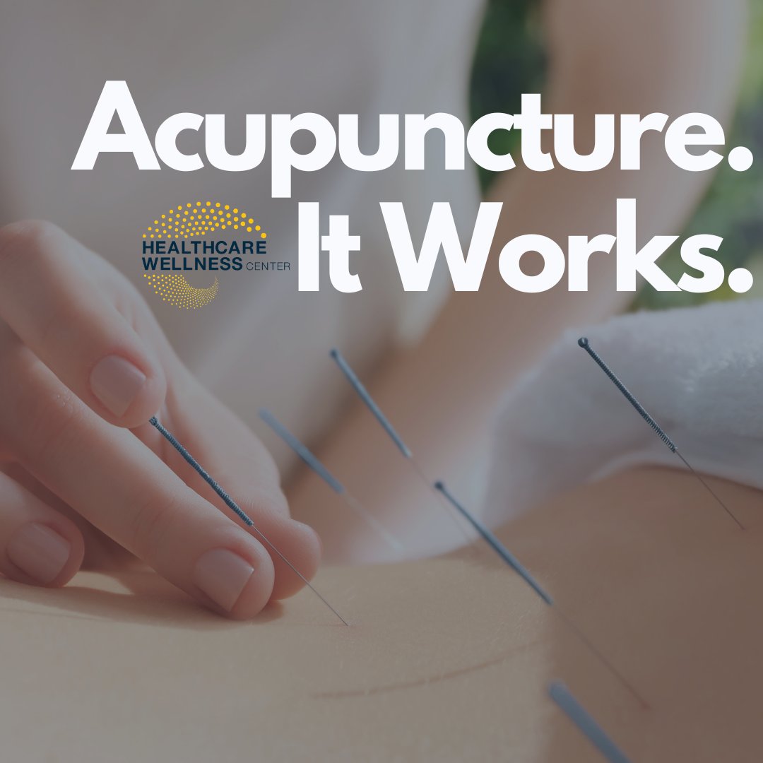 HealthcenterLI's tweet photo. If you haven't tried acupuncture yet, what are you waiting for? We have a great team of practitioners who are here Monday to Saturday to help you feel your best. And, it's not just for pain relief.  Visit our website to learn more. https://t.co/SAVMcN3wkn https://t.co/1Ar5gEmI0y