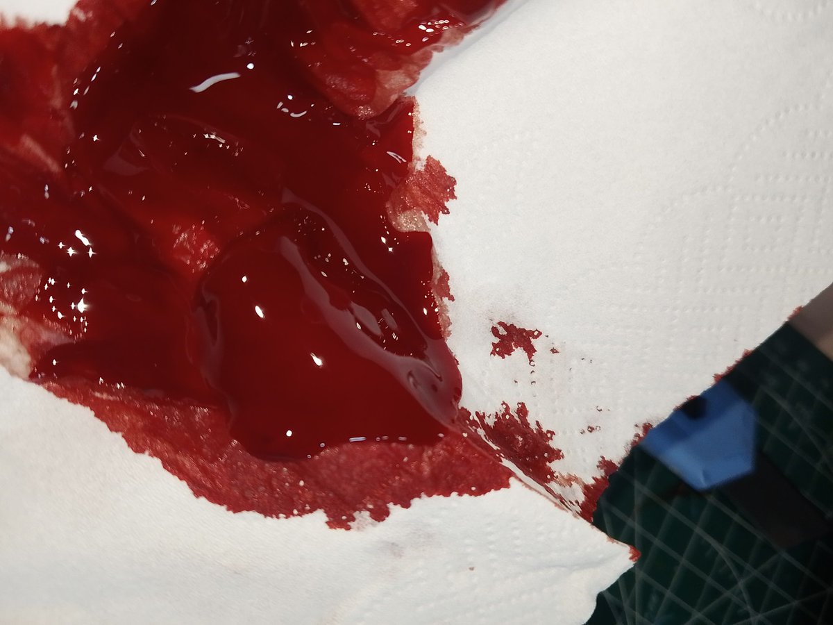 Joey_0078's tweet photo. #Halloweenmakeup #fakeblood #fakeall https://t.co/ef2bb1L3cc