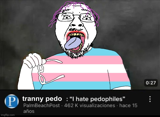 Bigoderesenha's tweet photo. I see no diff btw https://t.co/4r8Qr3rhfI