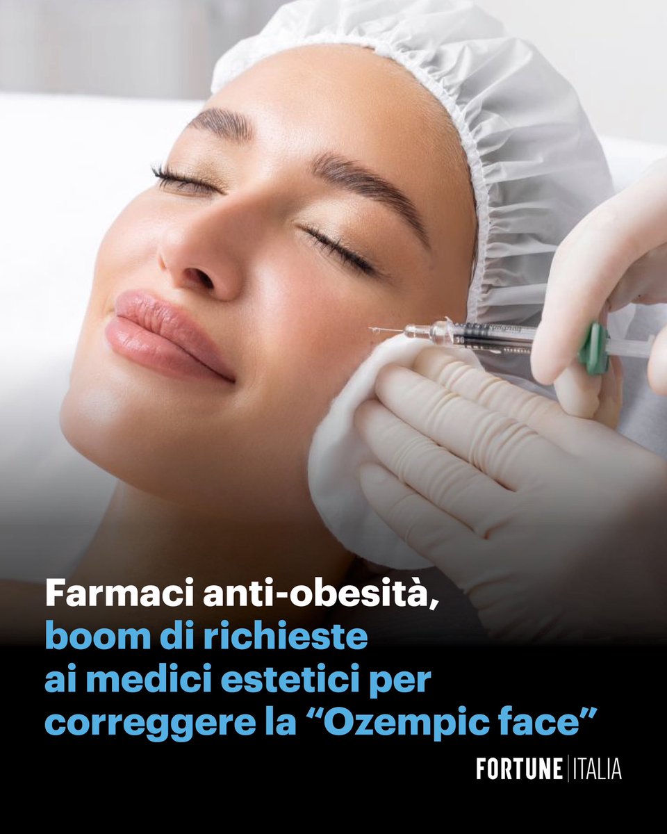 fortuneitalia's tweet photo. Sempre più pazienti chiedono trattamenti per correggere i segni del dimagrimento rapido, il fenomeno ribattezzato sui social “#Ozempic face” e “Ozempic body”.

👉 Leggi l’articolo completo online al link https://t.co/WDSlckWwd2 https://t.co/q2ZZchcApT