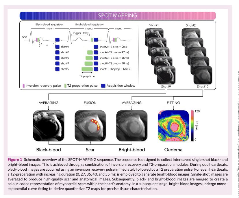 cardiopedhnn's tweet photo. https://t.co/US9MVbdfI2

#original_article #whyCMR https://t.co/2INF7kO7LS