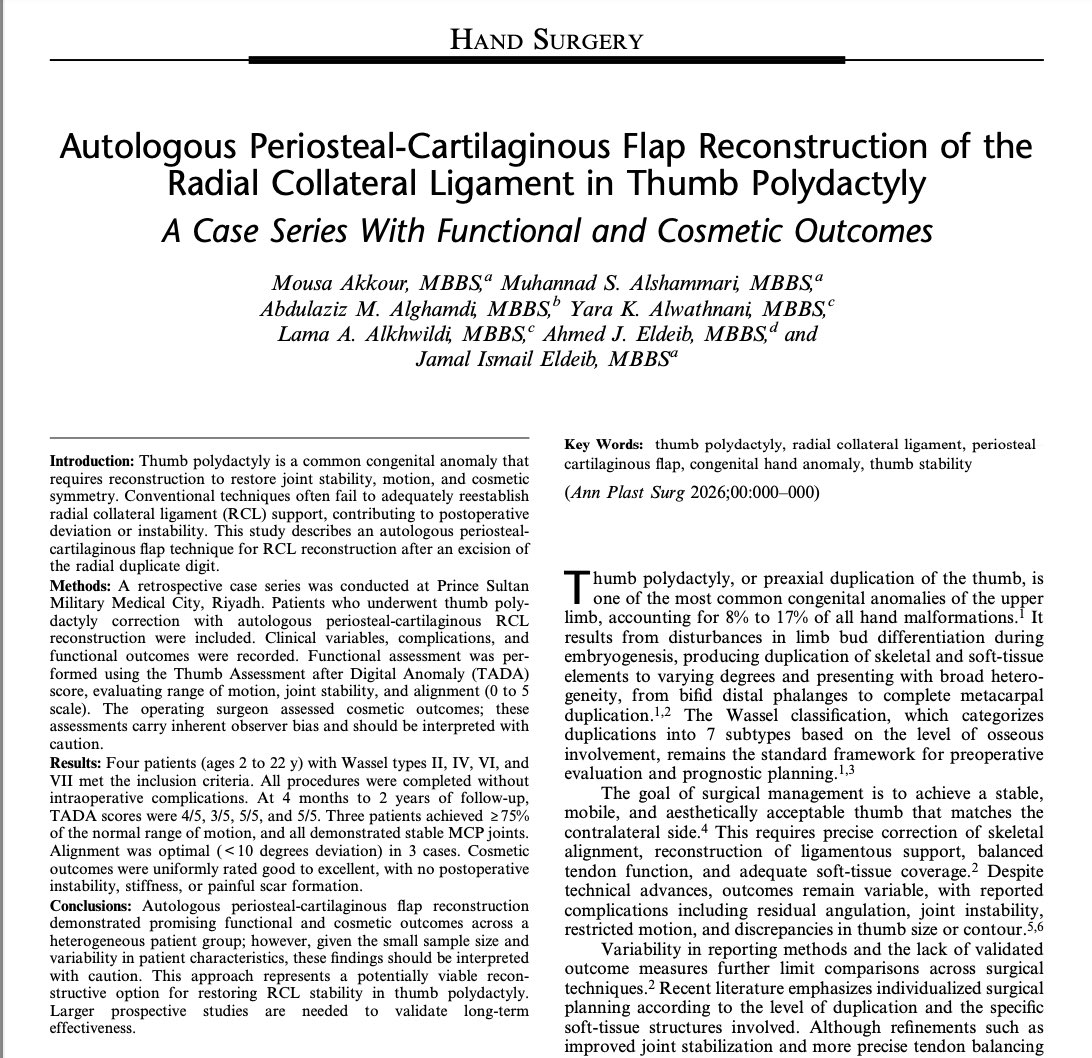 Nervesguy's tweet photo. Our recent congenital pediatric hand surgery paper entitled “Autologous Periosteal-Cartilaginous Flap Reconstruction of the Radial Collateral Ligament in Thumb Polydactyly” was published in Annals of Plastic Surgery

https://t.co/MangP6S1hl https://t.co/w8QutGC4ZK