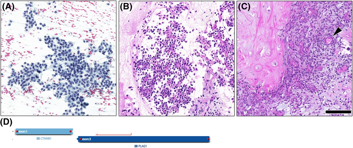 Cancer Cytopathology tweet media