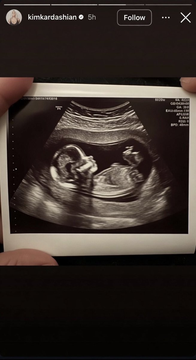 vahphor's tweet photo. Kim Kardashian reportedly posted that she’s expecting a baby with Lewis Hamilton and later deleted it. Lewis has already been interacting with fans during yesterday’s Formula 1 testing. Congratulations to them. https://t.co/67Olj4Q2og