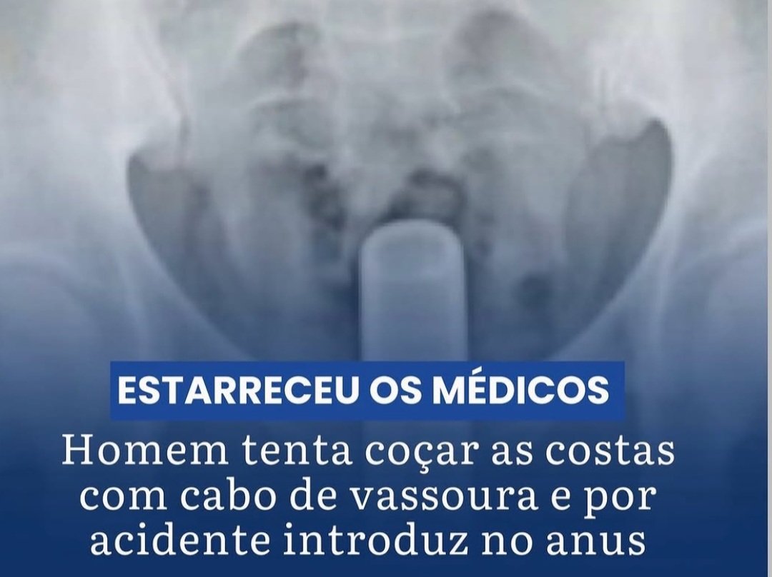 orepiteiro tweet media