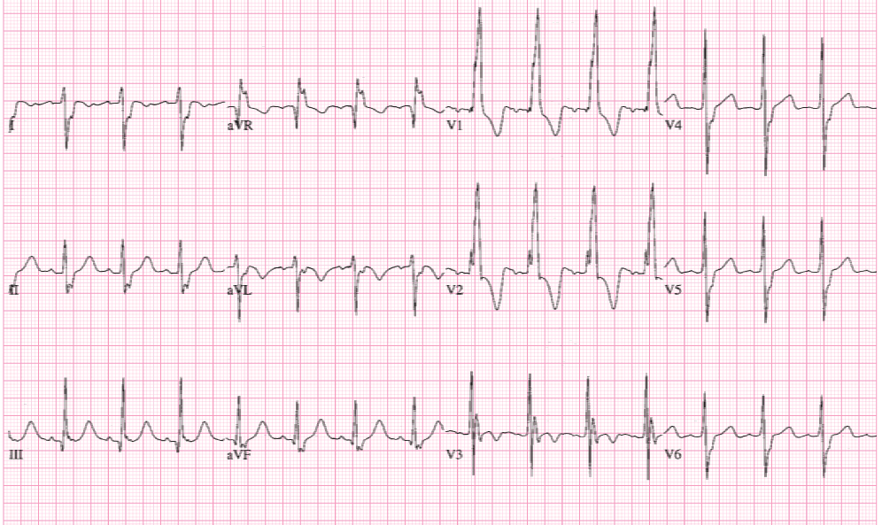 CardiovascularCorner tweet media