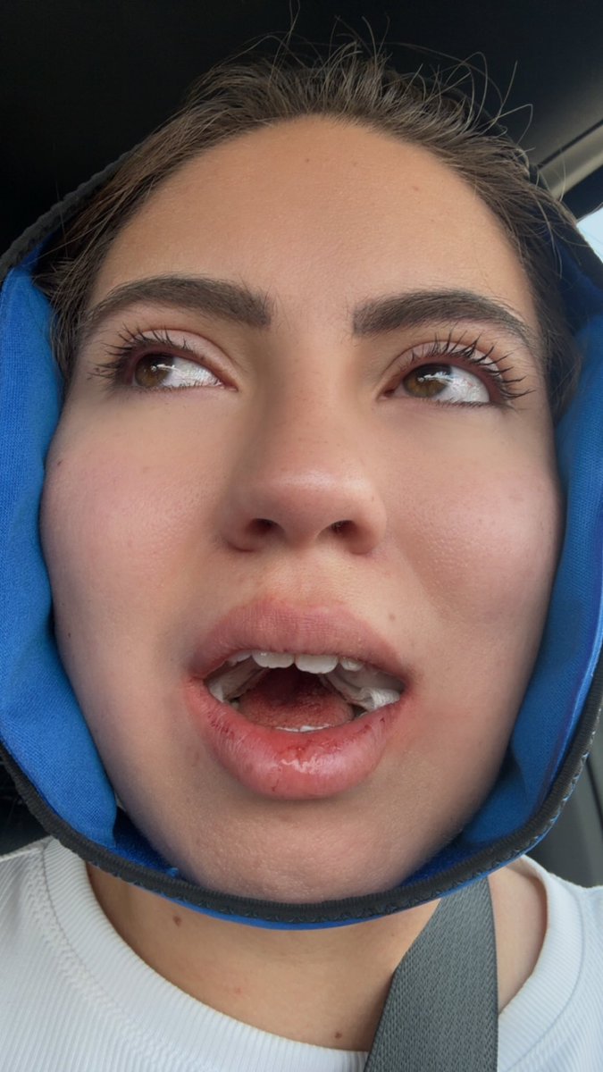 MoriahSoltero's tweet photo. Darien getting his masters tomorrow I’m getting out of emergency surgery… yikes sorry baby 💀🤷‍♀️ https://t.co/LcpdwLCEqV