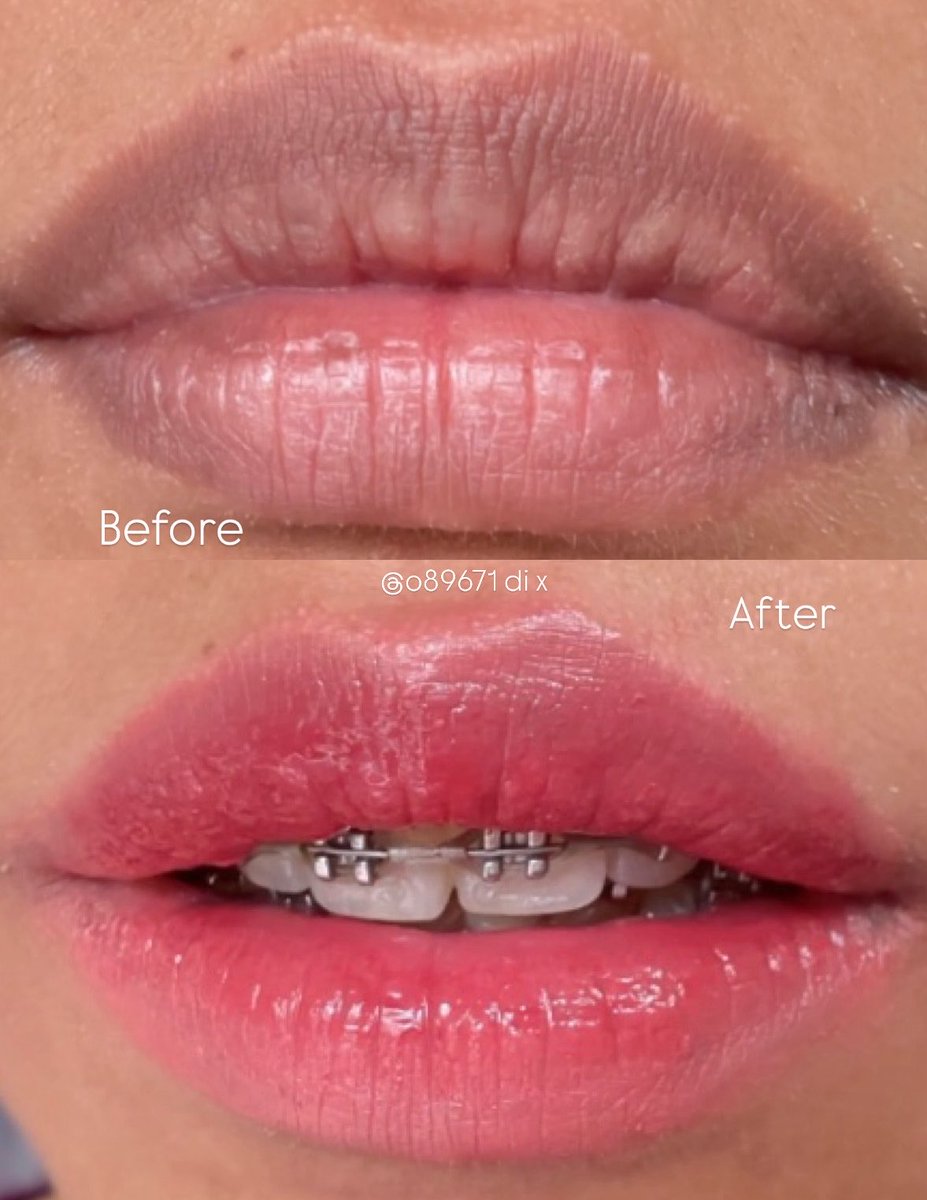 o89671's tweet photo. Tips kalau punya buat bibir gelap tp pengen hasil lippie pink cakep jangan tutupin pake ❌CONCEALER❌

Malah bikin bibir jadi patchy, kering, dan hasil warnanya kurang nyatu <\3 https://t.co/3FXGwbYphb