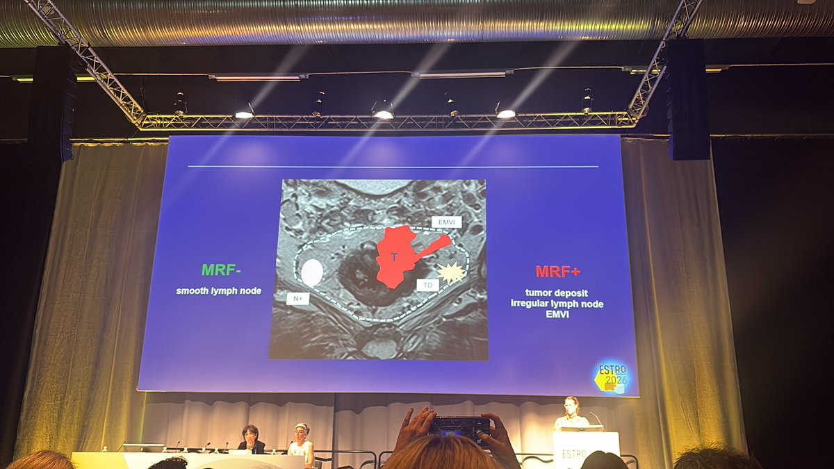 DigestivoSEOR's tweet photo. ESTRO26:  Nuevas guías de estadificacion de Cáncer de RECTO https://t.co/amDYGbh9L3 https://t.co/H6ZtE9jGiV