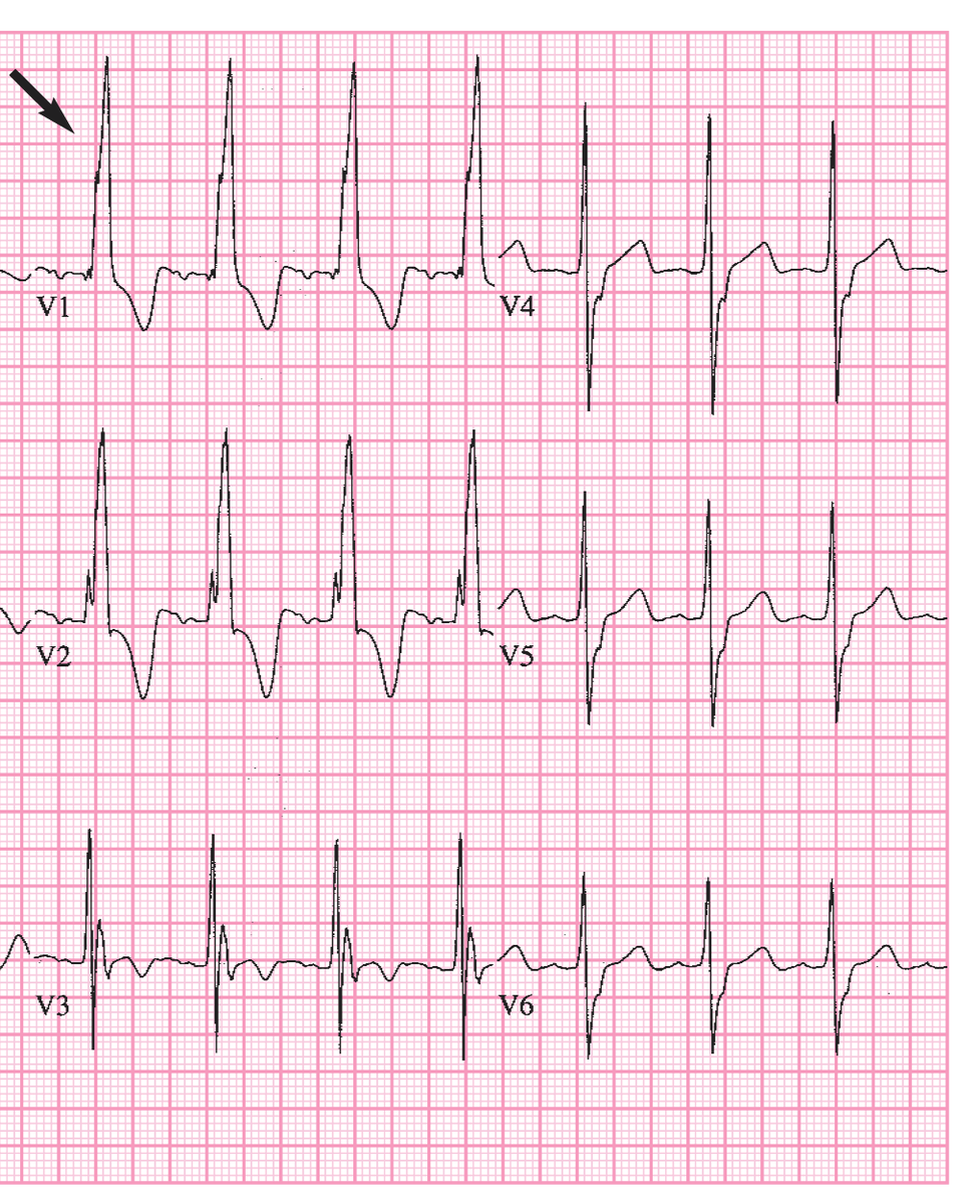 CardiovascularCorner tweet media