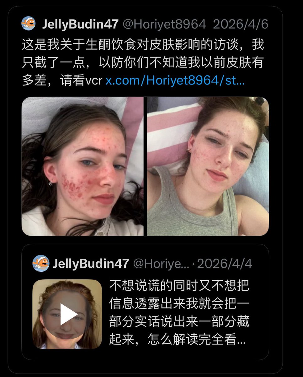 Cyclo(评论我会用小号回 tweet media