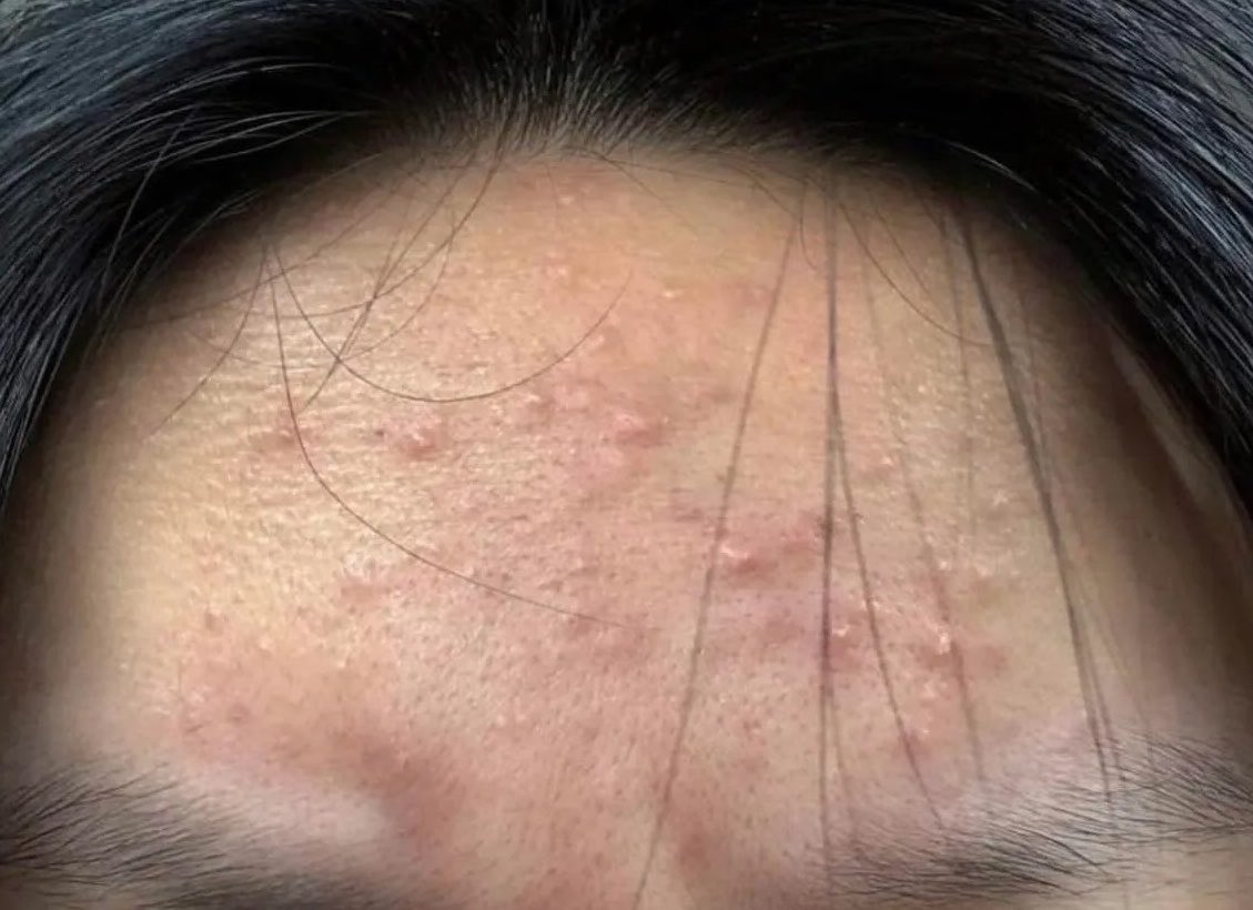 venggk's tweet photo. GUE GA BISA TANPA INI 😭😭 kalo kalian males skincare berlayer2 pls minimal punya ini satu aja…

soalnya tiap skin barrier rewel, merah, atau breakout, ini selalu jadi penyelamat pertama 😭🙏￼ https://t.co/zgxzZcSOg1
