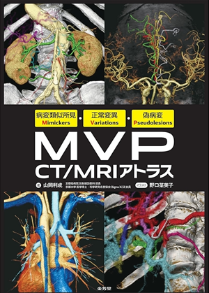 献本御礼】病変類似所見Mimickers・正常変異Variations・偽病変